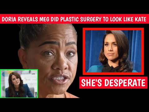SHE ENVIES KATE! Doria Spills Meghan Desperately Did Extensive Plastic Surgeries To Look Lik